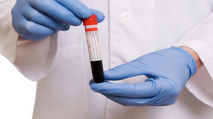 Disean un biosensor para diagnosticar celiaqua