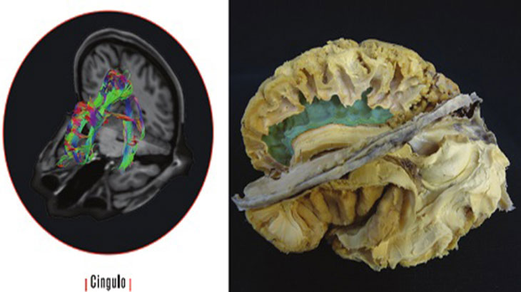 Otra forma de estudiar el cerebro