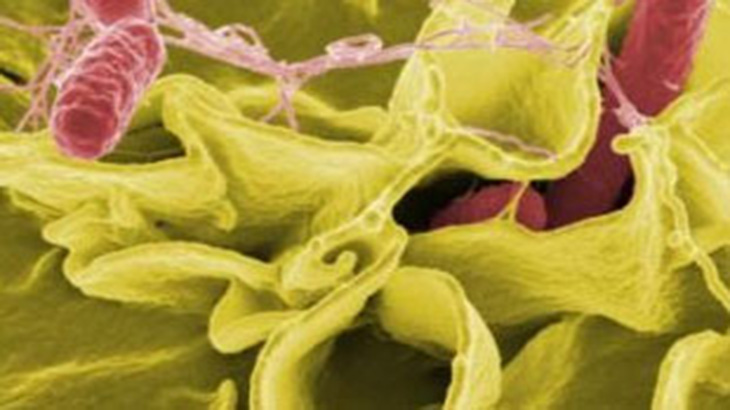 Hallan mtodo para evitar la contaminacin de alimentos